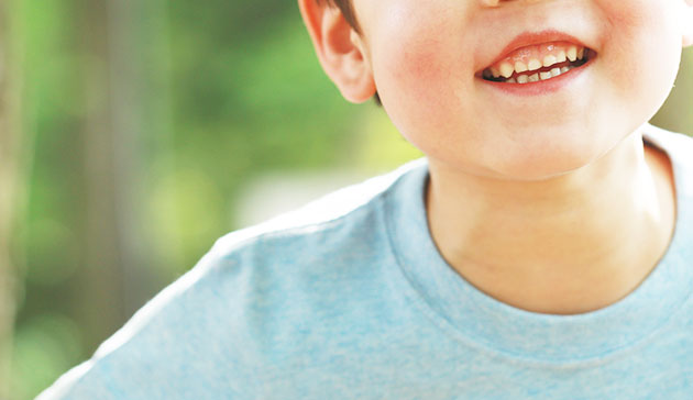 【PR】予防できる！子供のガミースマイル矯正のイメージ